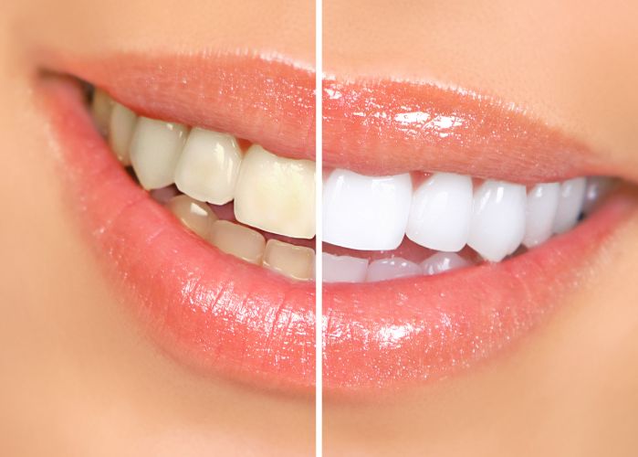 woman white teeth